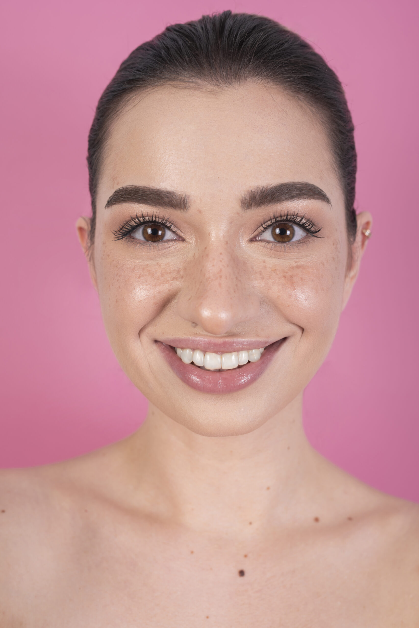 ¿Qué son los Neuromoduladores? Beneficios y Resultados