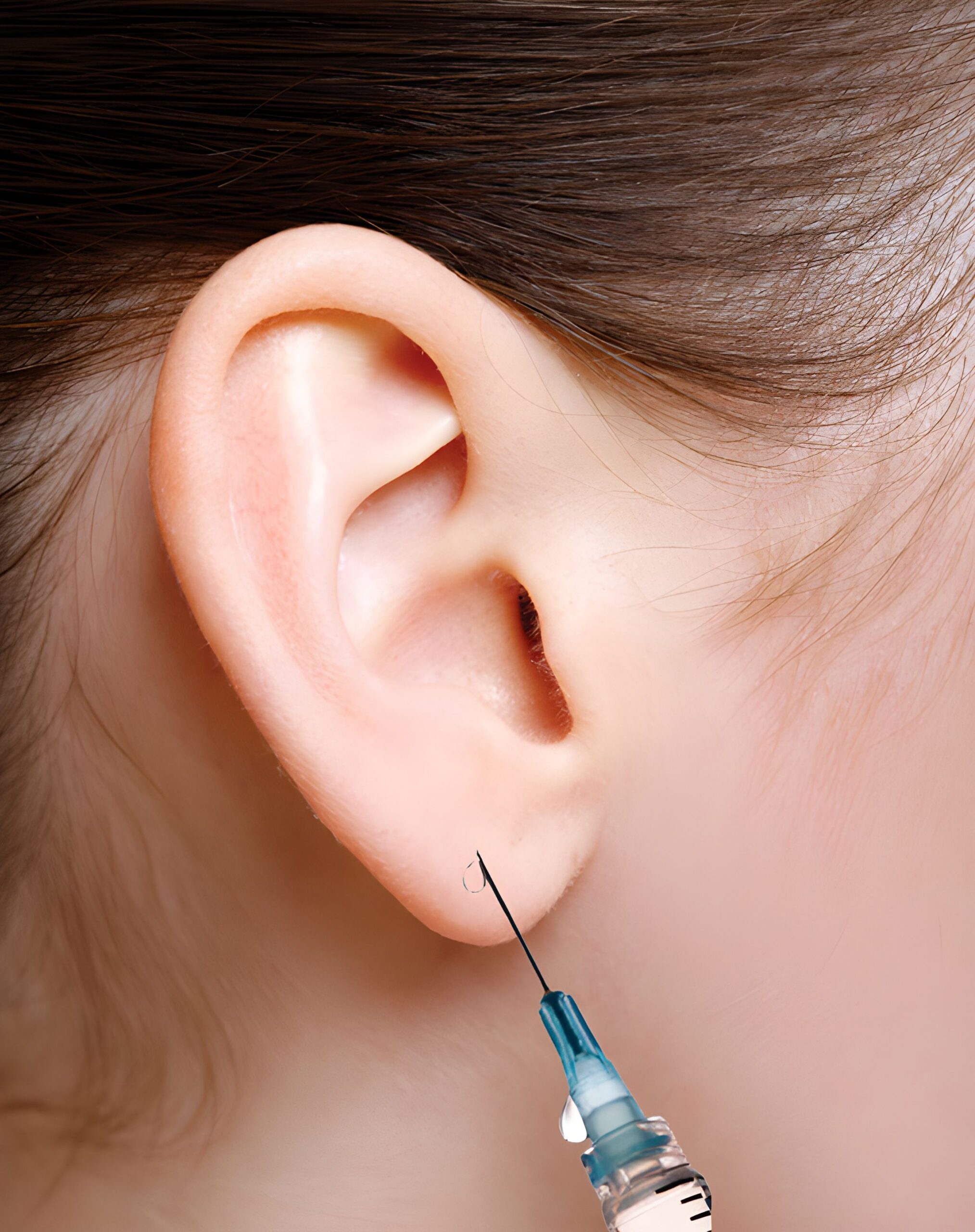 Lóbulo de las orejas